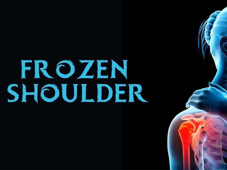 Frozen Shoulder And Diabetes Diabetesmine