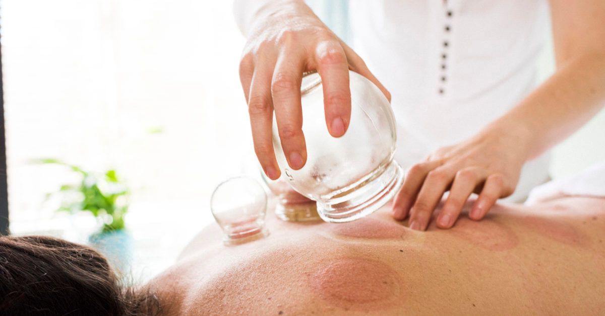 Cupping TherapyWhat Is It And Should You Try It