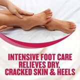 Gold Bond Ultimate Foot Cream Diabetics Dry Skin Relief - 3.4 oz