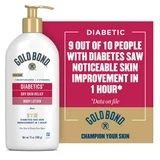 Gold Bond Diabetic Skin Relief Lotion with Aloe - 13 oz