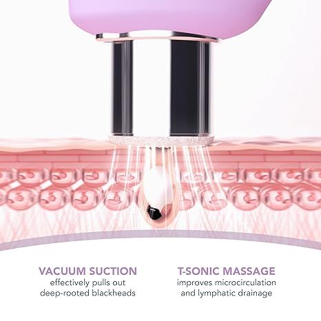 FOREO KIWI™ Derma Diamond Microdermabrasion Pore Vacuum - Lavender