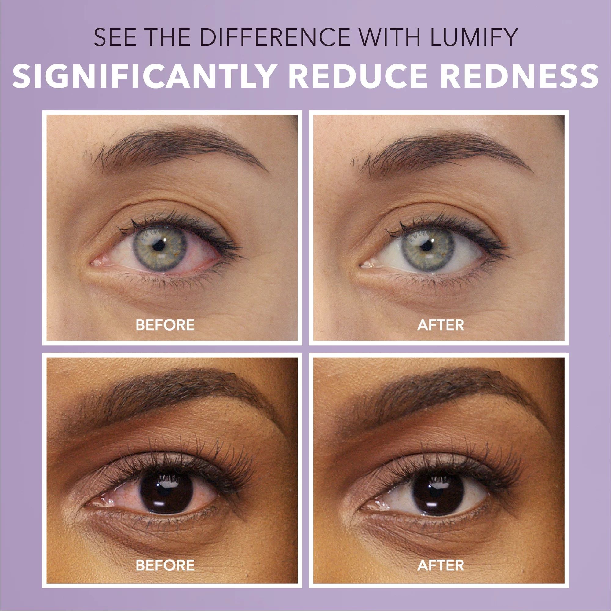 Lumify Redness Reliever Eye Drops - 0.25 fl oz