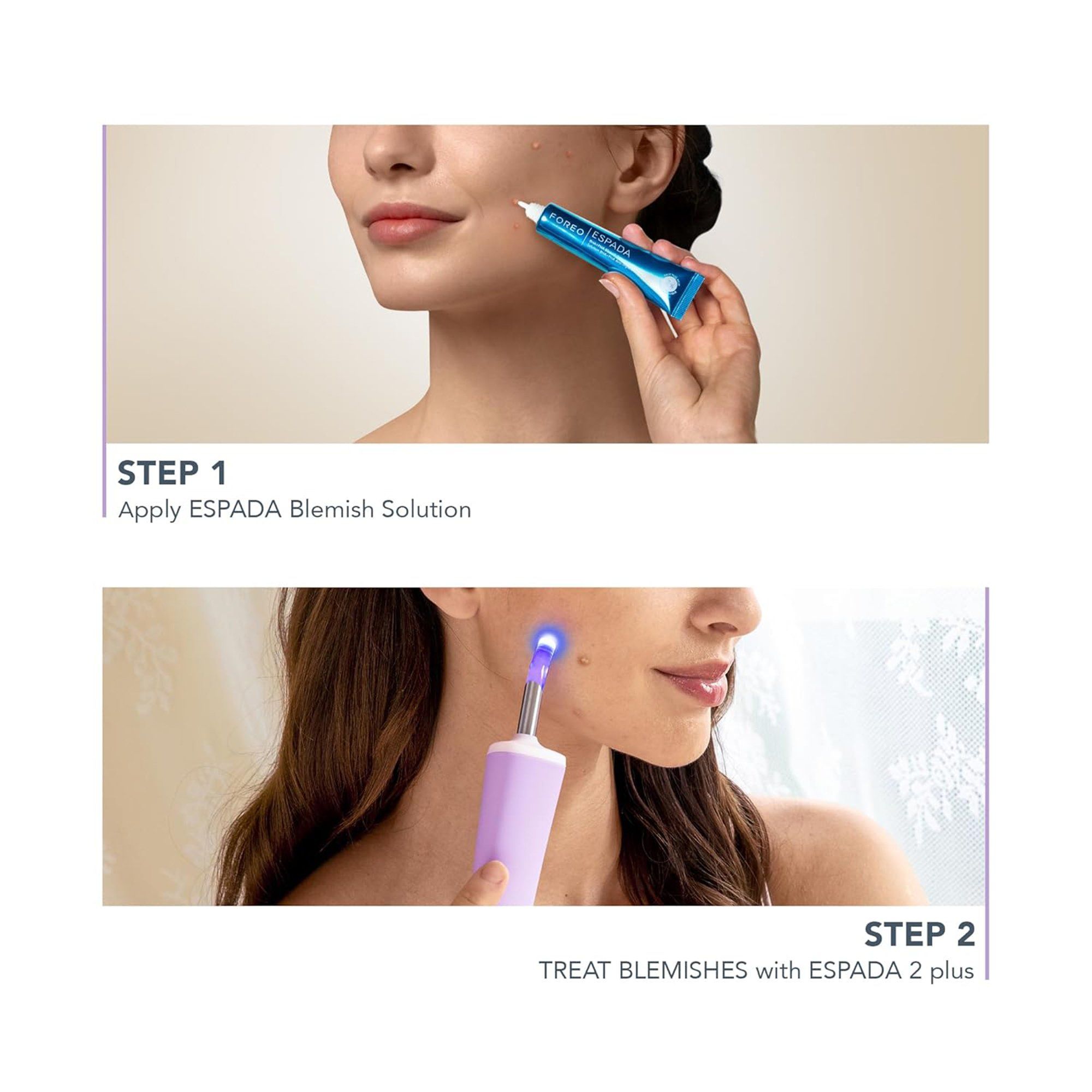 Espada 2 Plus Acne Treatment | Optum Now