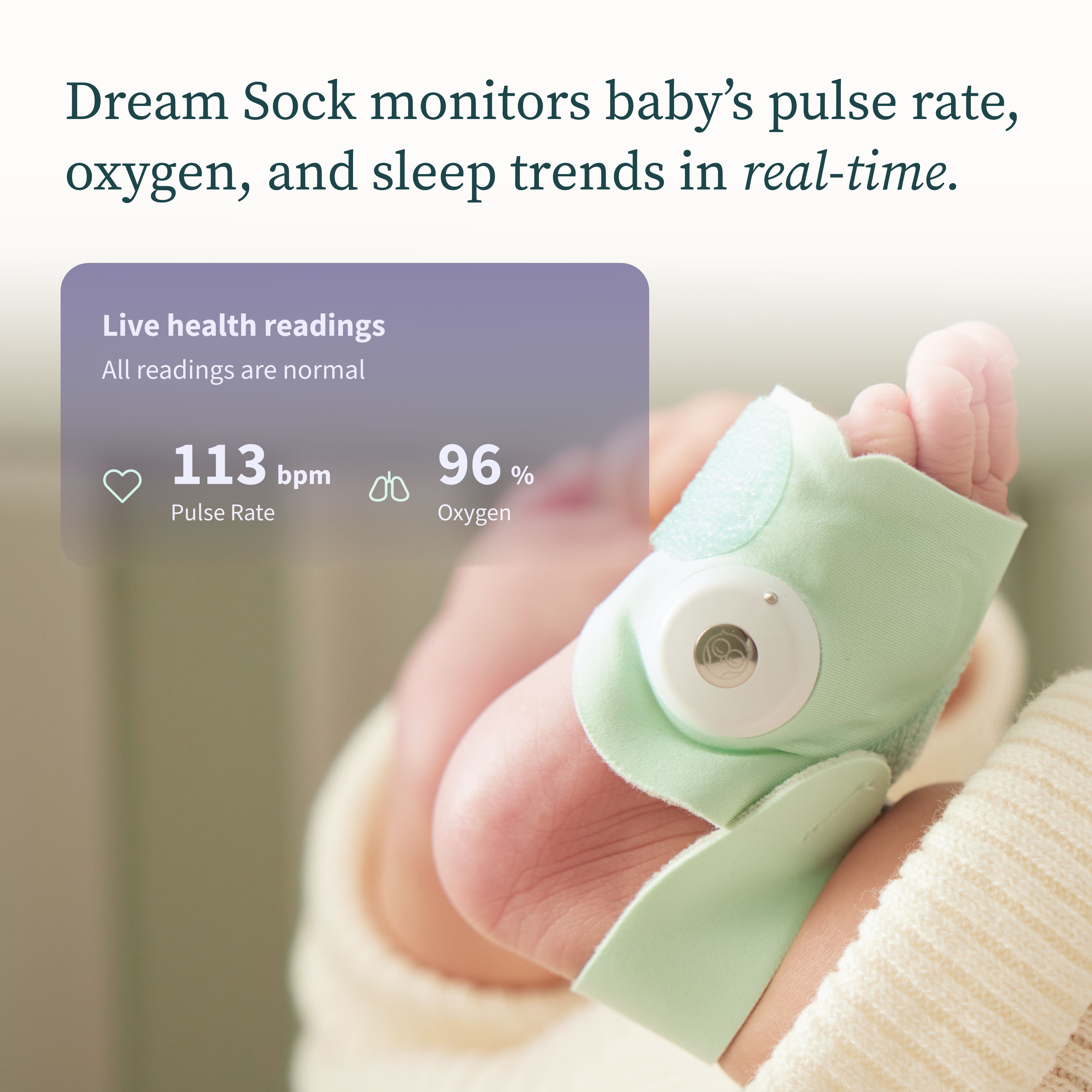 Owlet Dream Sock - FDA-Cleared Smart Baby Monitor with Live Health 
