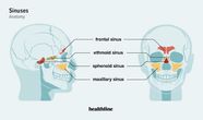 Where Are Your Sinuses When Is A Biologic Indicated For Chronic Where Are Your Sinuses When Is A Biologic Indicated For Chronic