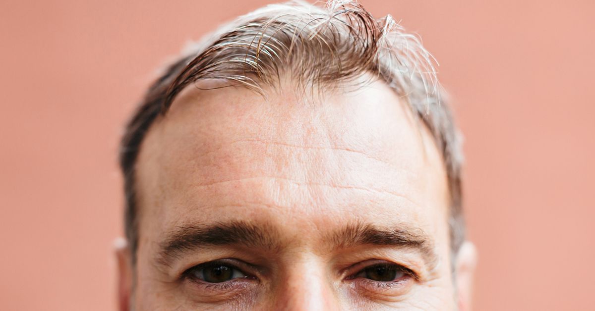 Types of Disease That Cause Hair Loss Manhattan, NYC - The Hair Loss Doctors
