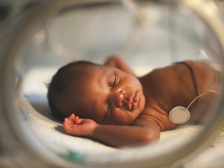 Why 'Microbial Seeding' May Help Babies Born Via CSection