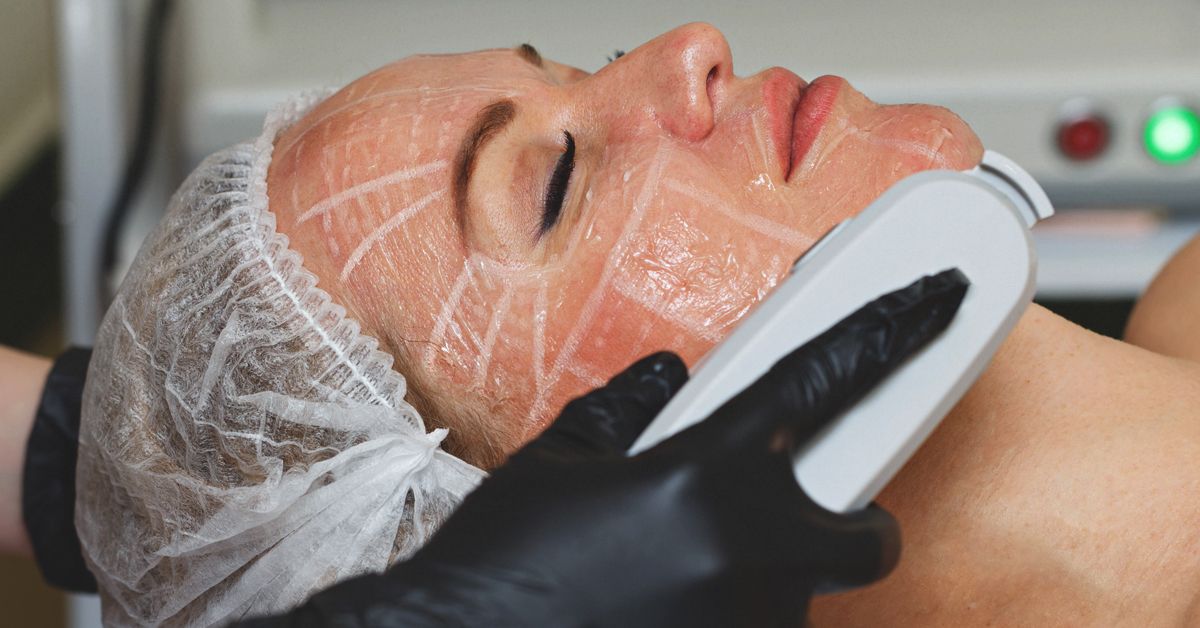 Ultra Lift Skin (HIFU) - Non-Surgical and Non-Invasive Treatment