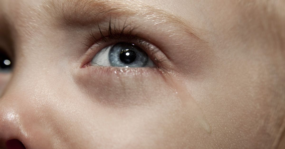 Ephiphora: What Causes Teary Eyes?