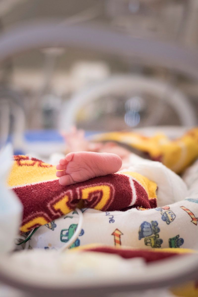 Harlequin Ichthyosis: Definition, Symptoms, Treatment, and Prognosis