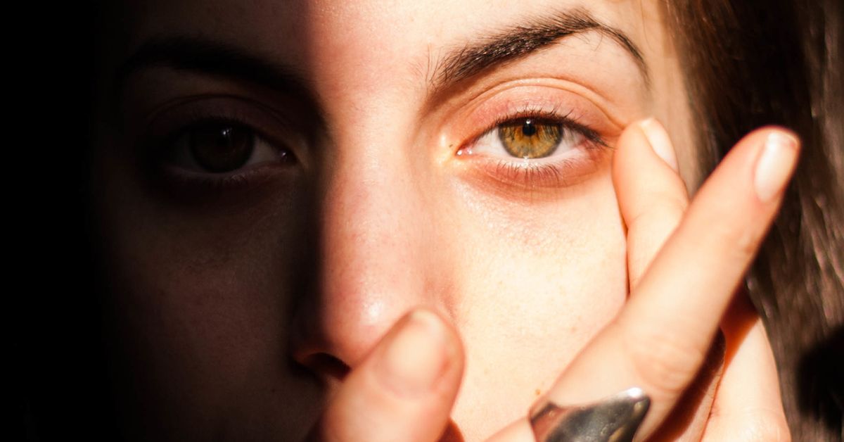 Sunburned Eyes Causes, Symptoms, and Treatment