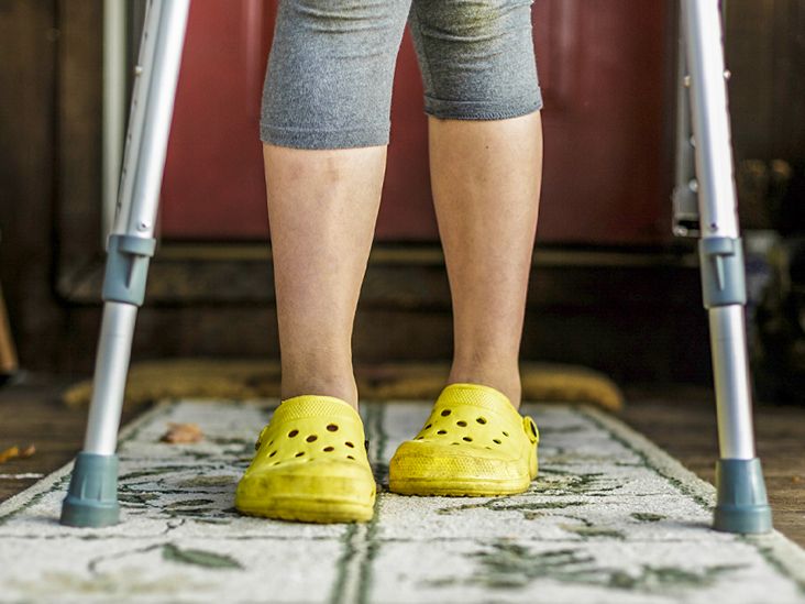How to Tell Broken Ankle vs Sprain - Vive Health