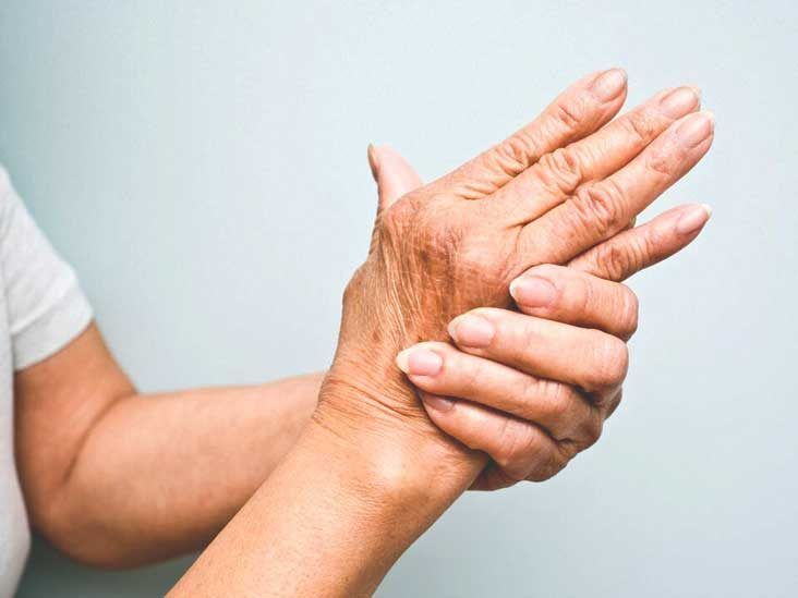 Everything You Need to Know About Psoriatic Arthritis