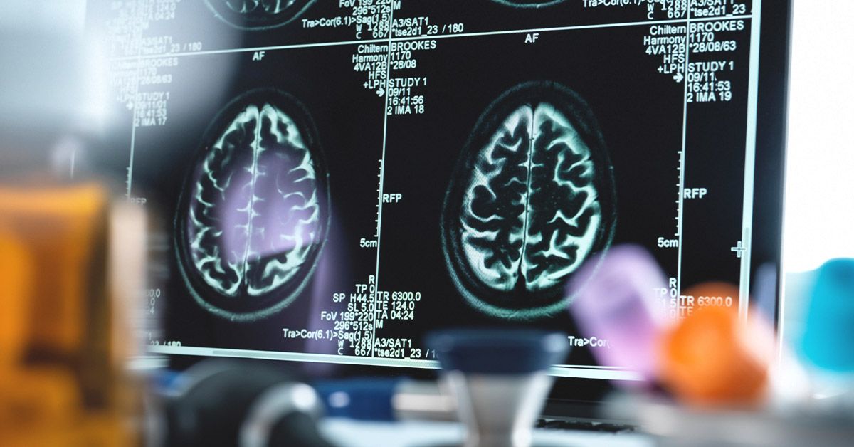 Addictive personality traits: why they're a myth