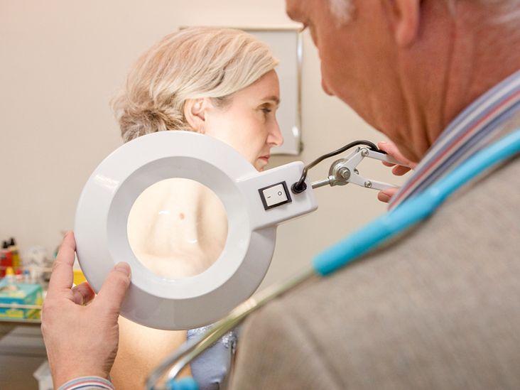 Everything You Need to Know About Melanoma