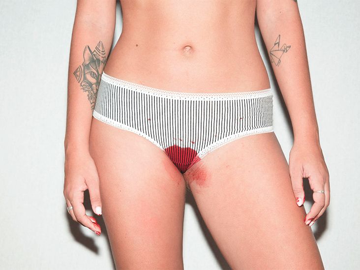 Menstrual Period Leak Proof Panties Underwear Women Briefs Knickers  Underpants - International Society of Hypertension