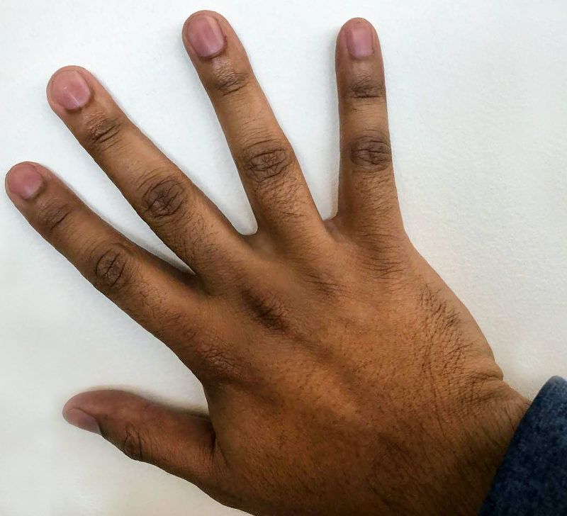 Fingers that change color Information