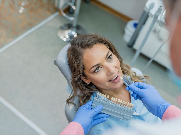 Teeth Bonding: What to Expect If You Have Your Teeth Bonded