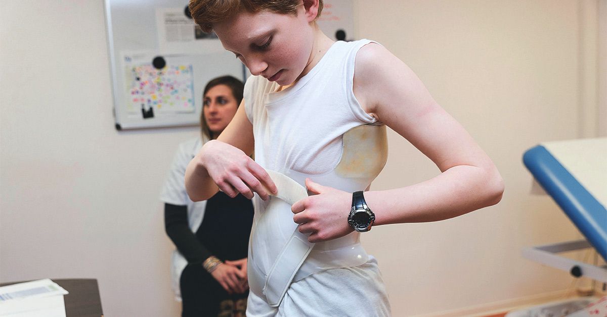 Choosing the Right Scoliosis Brace for Effective Treatment