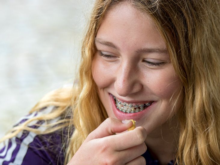 What Is Orthodontic Headgear and How Does It Help Straighten Teeth?