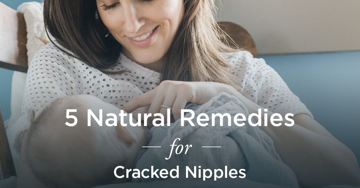 Cracked Nipples: Natural Remedies