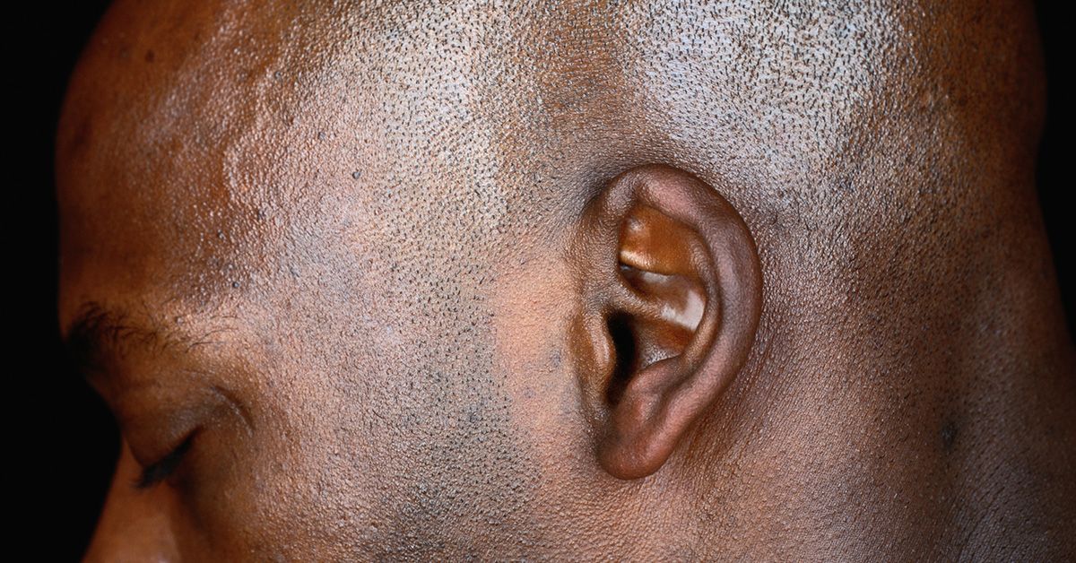 Do your ears pop in winter? This is why