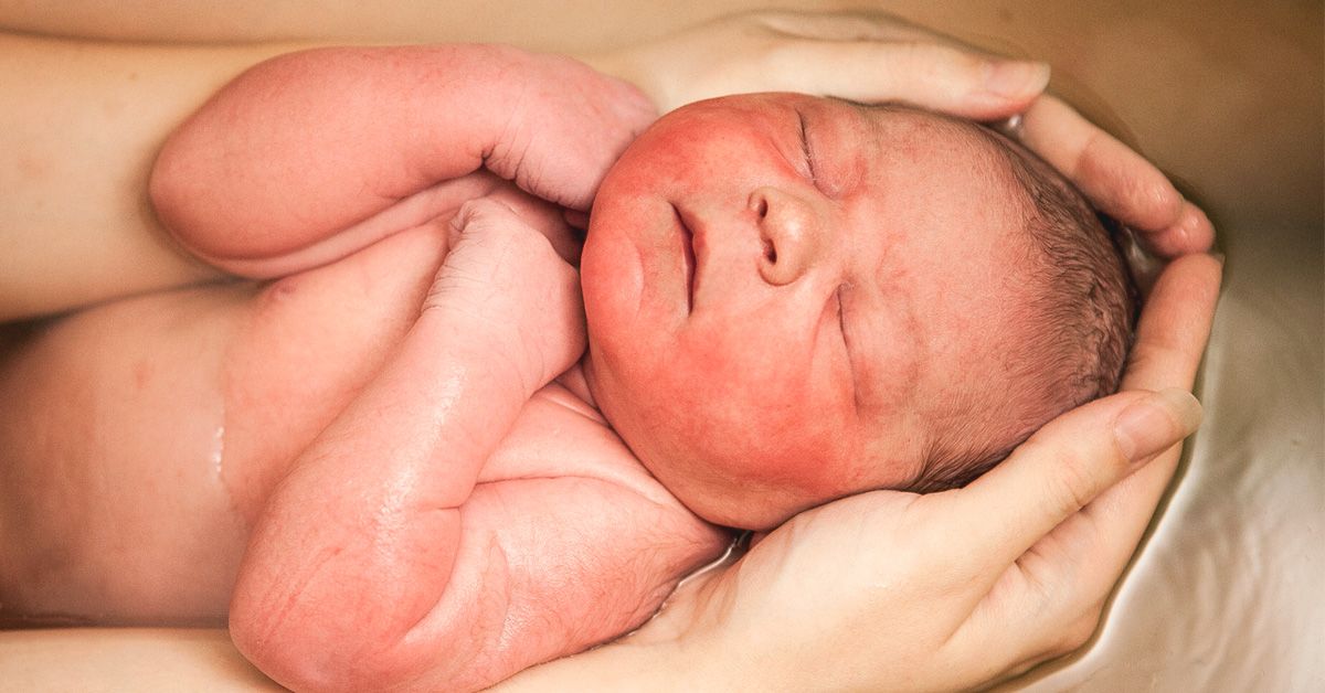 Water Birth: Benefits, Risks, Costs, What to Expect, and More
