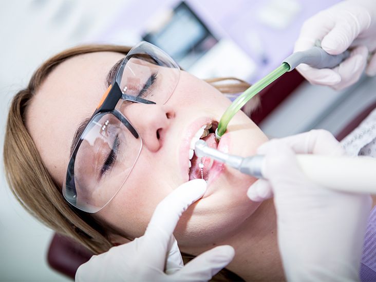 What To ﻿Do If Your Tooth Filling Falls Out