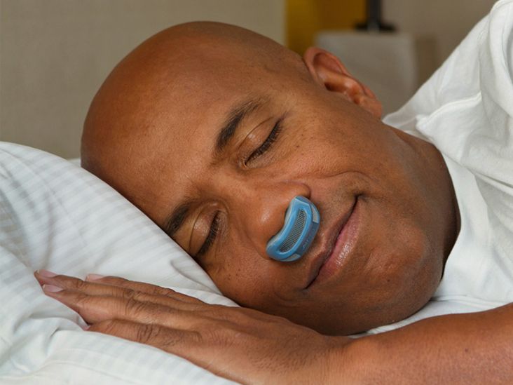 For Sleep Apnea, a Mouth Guard May Be a Good Alternative to CPAP - The New  York Times