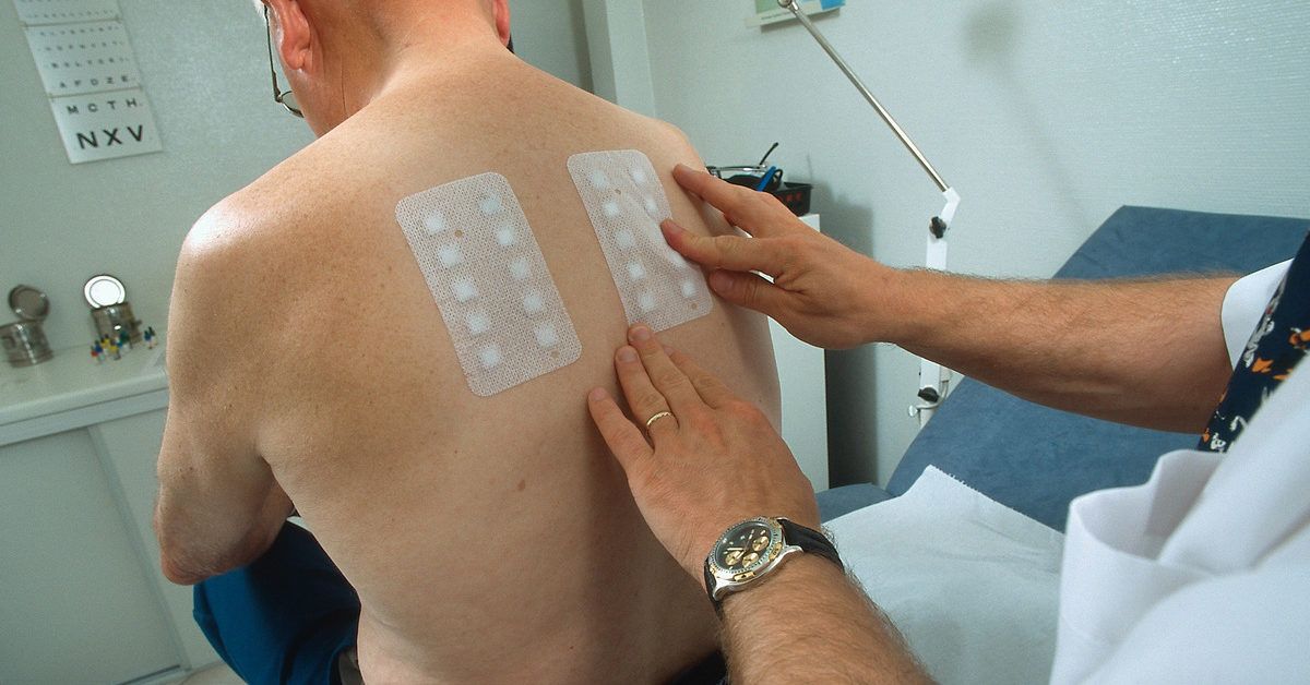 Does Medicare Cover Allergy Testing? Coverage, Tests &amp; Cost