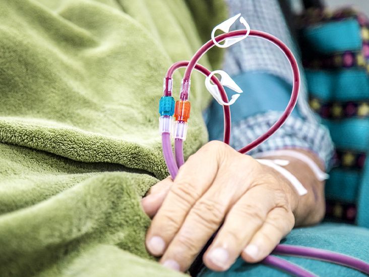 Does Medicare Cover Dialysis? Eligibility, Coverage, Cost