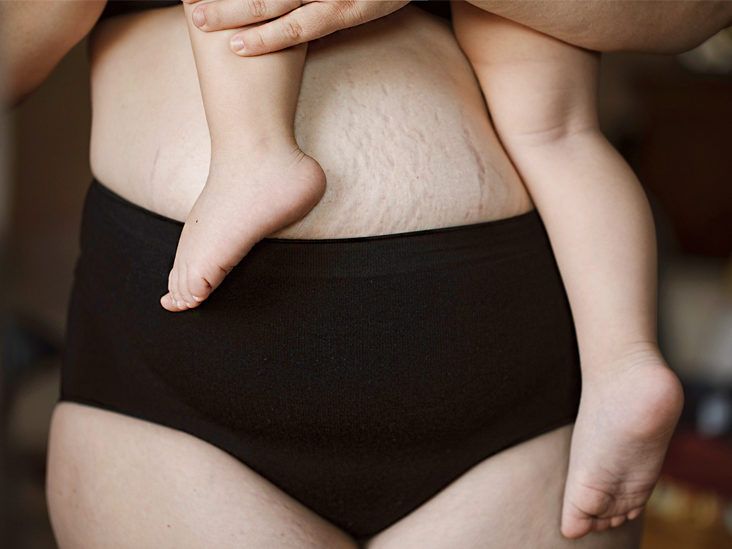 Reusable Postpartum Underwear Pregnancy Panties Incontienece