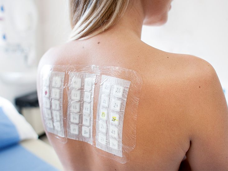 Should I Get Tested for Food Allergies If I Have Ulcerative Colitis?
