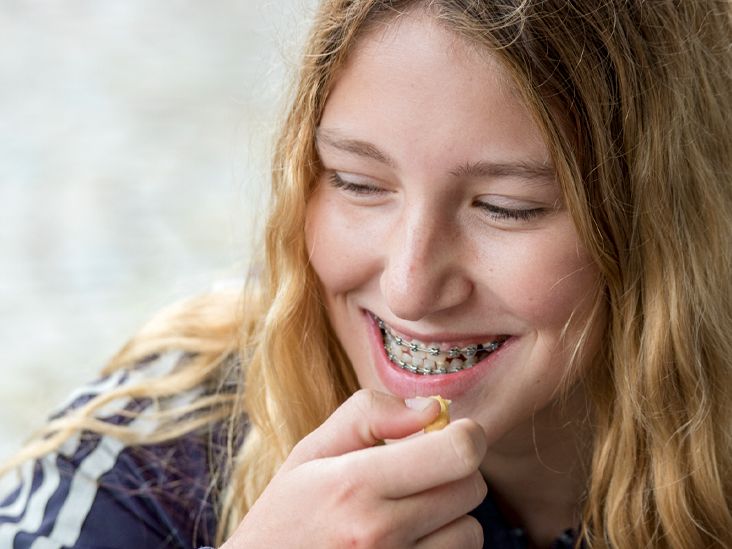 Swollen Gums with Braces Causes, Treatments, and More