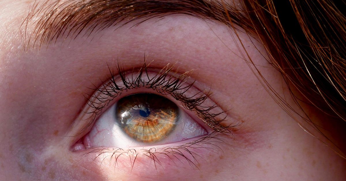 How to Fix a Lazy Eye: Treatment Strategies