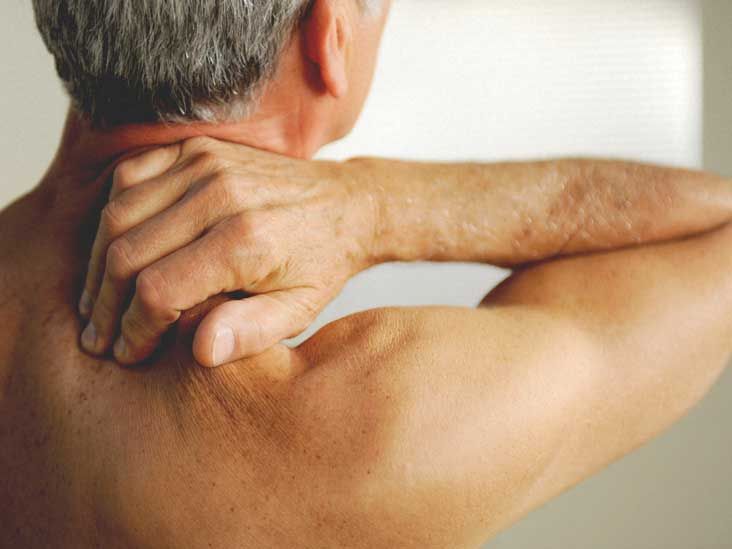 Fibromyalgia Tender Points Locations and Tips for Coping