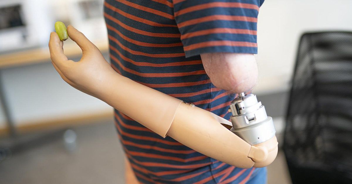 Real looking prosthetics for amputees