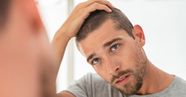 Dry Hair In Men Causes Treatment And Prevention