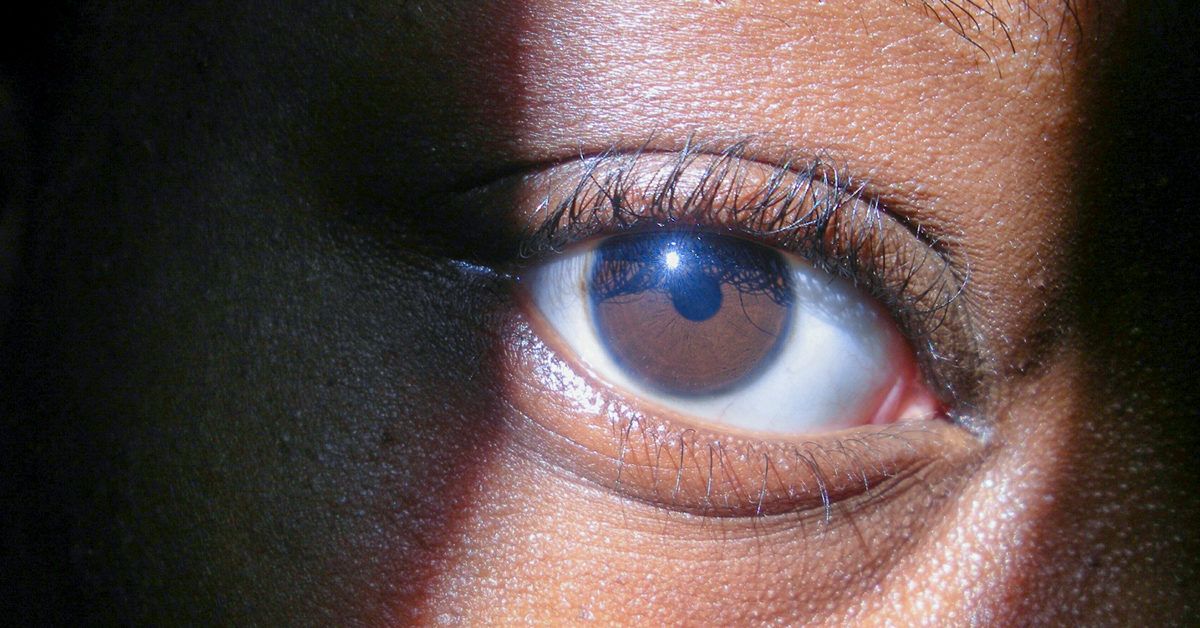 Blue Eye Limbal Ring Photo | JPG Free Download - Pikbest