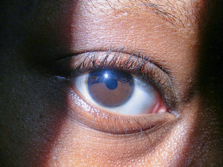 The History Of Black People With Blue Eyes