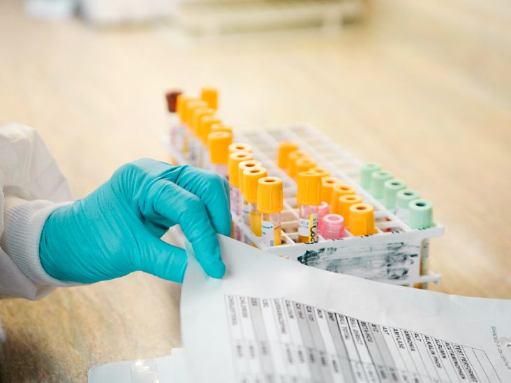 Does Medicare Cover the Coronavirus Antibody Test?