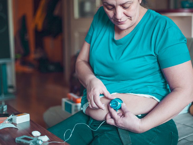 Medicare and Insulin Pumps: What You Need Know