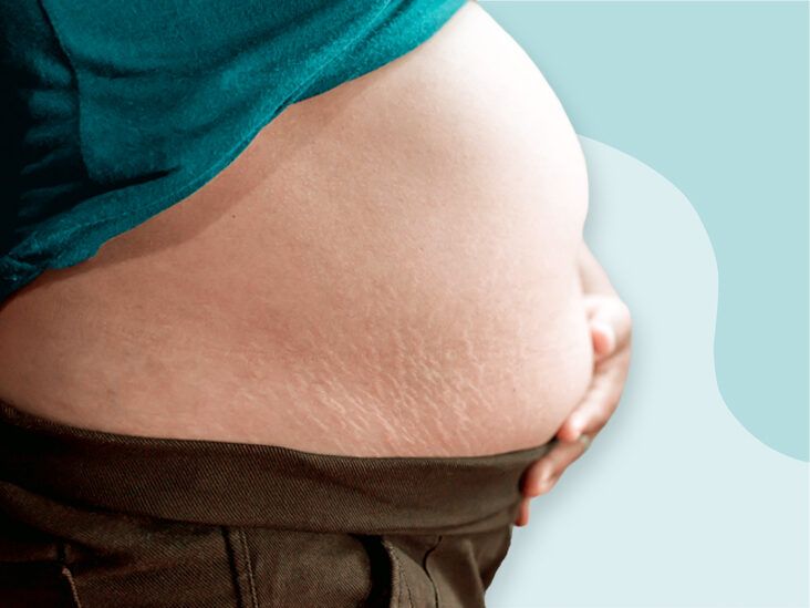 What happens to your belly button when you're pregnant?