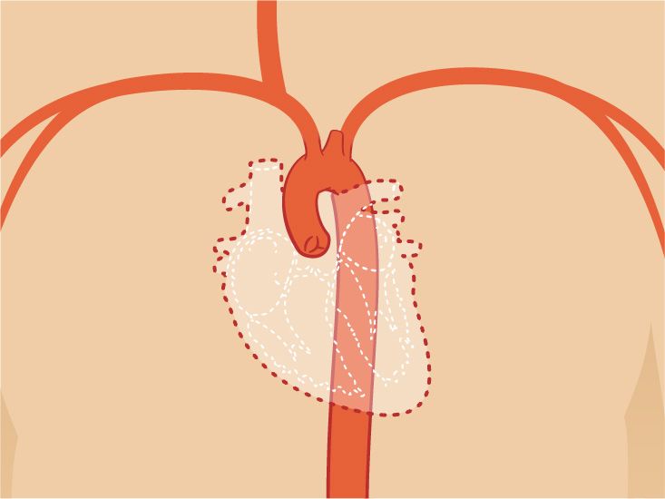 marginal-artery-diagram-anatomy-function-body-maps