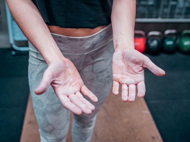 https://media.post.rvohealth.io/wp-content/uploads/2020/07/woman-showing-calluses-on-palms-in-gym-732x549-thumbnail.jpg