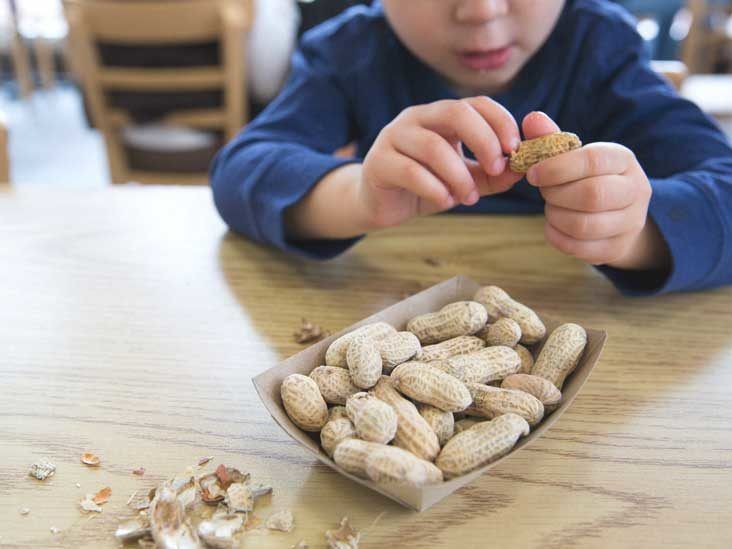 Kids and Food Allergies: What to Look For