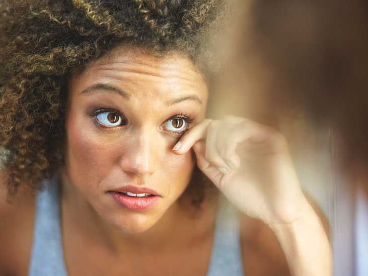 Nevus of Ota Treatment, Eye, Removal, and More