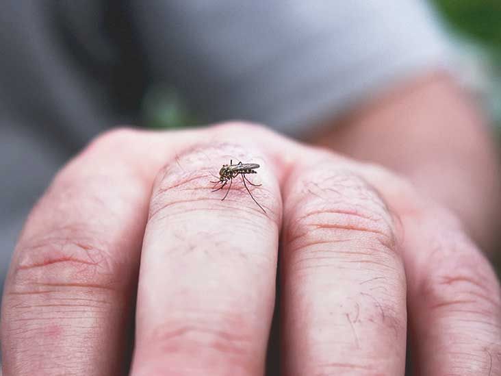 Zika Rash: Symptoms, Treatment, and More