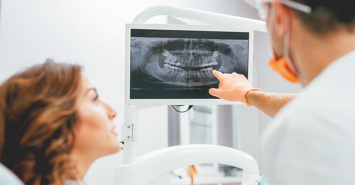 Dental X Rays Purpose Procedure and Risks