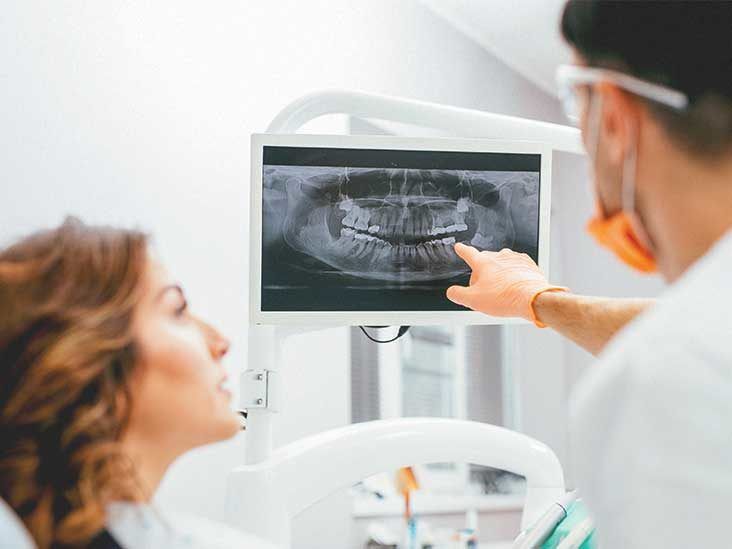 Dental X-Rays: Purpose, Procedure, and Risks